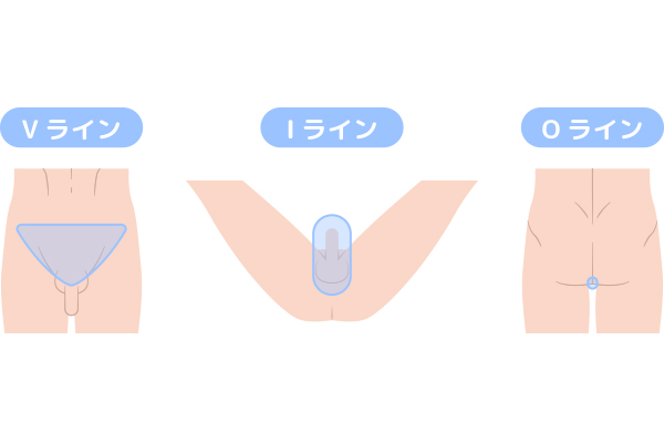 ＶＩＯの部位説明図
